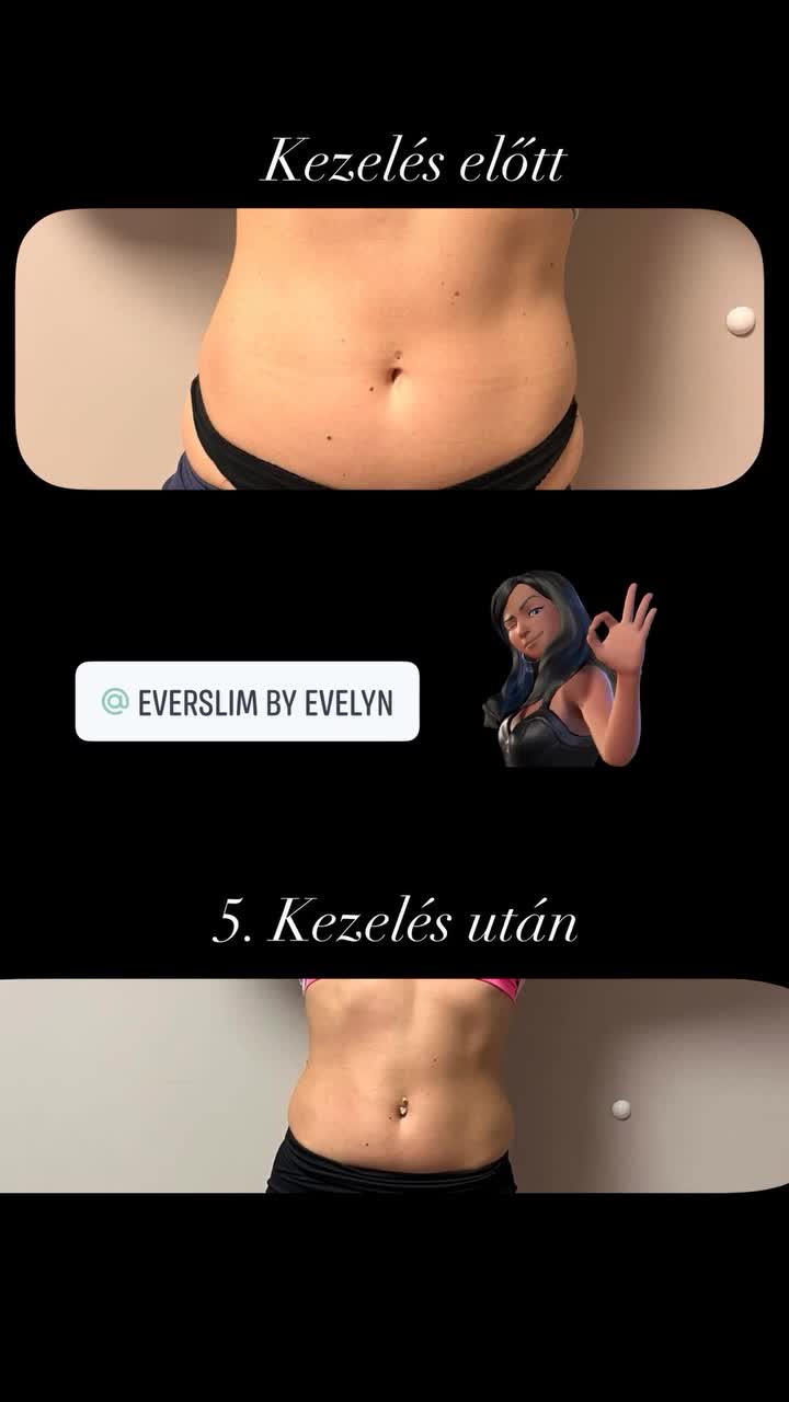 @EverSlim by Evelyn🌸