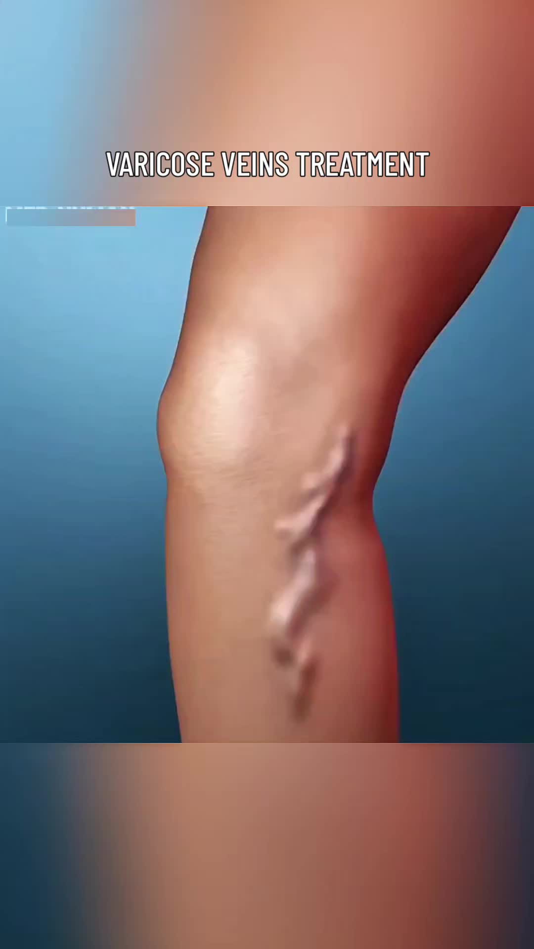 @Secret Body AI