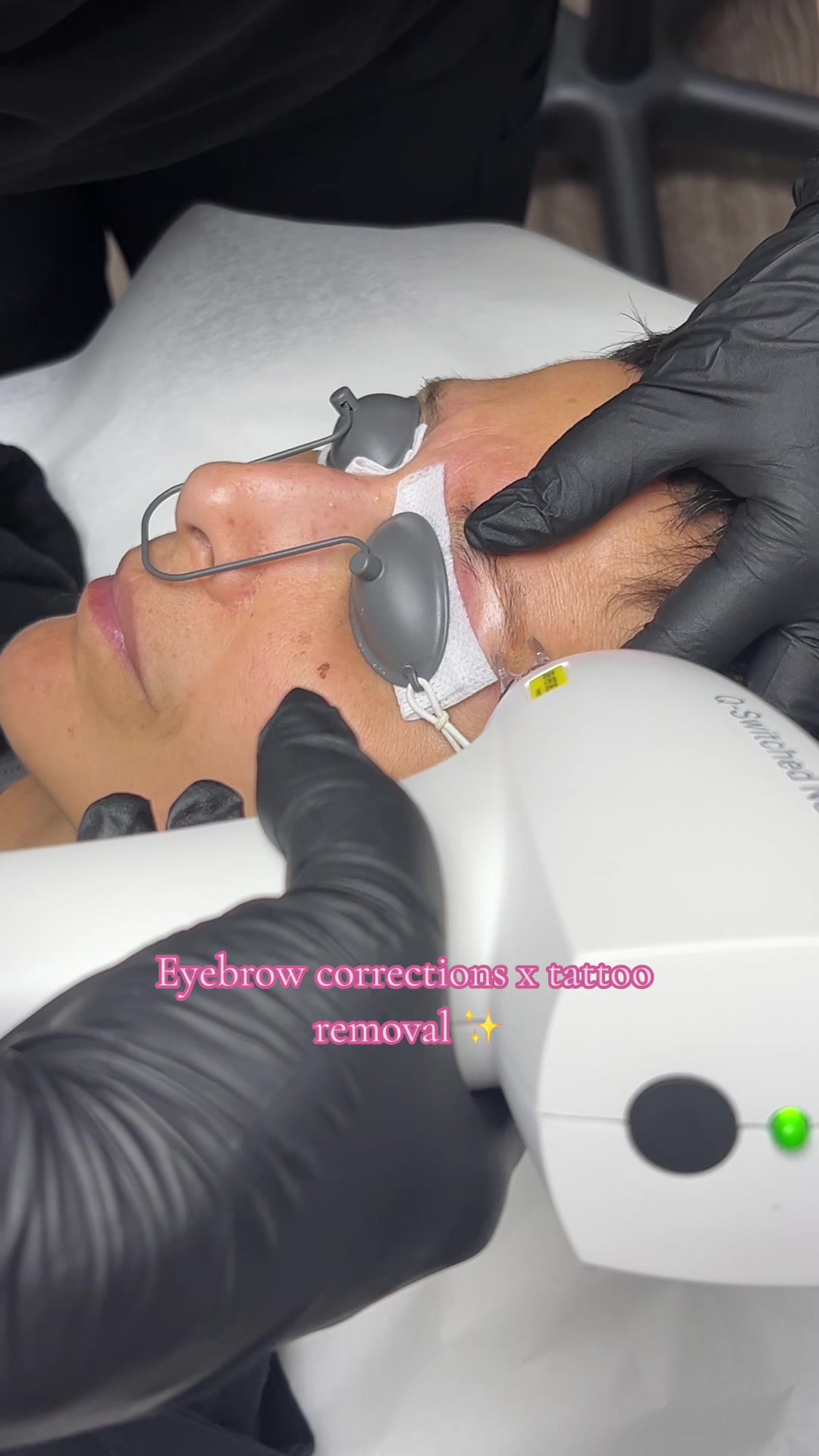 @Beauti4skin MedSpa