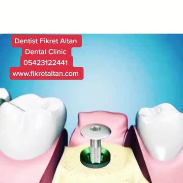 @DişHekimi Fikret Altan Dentist