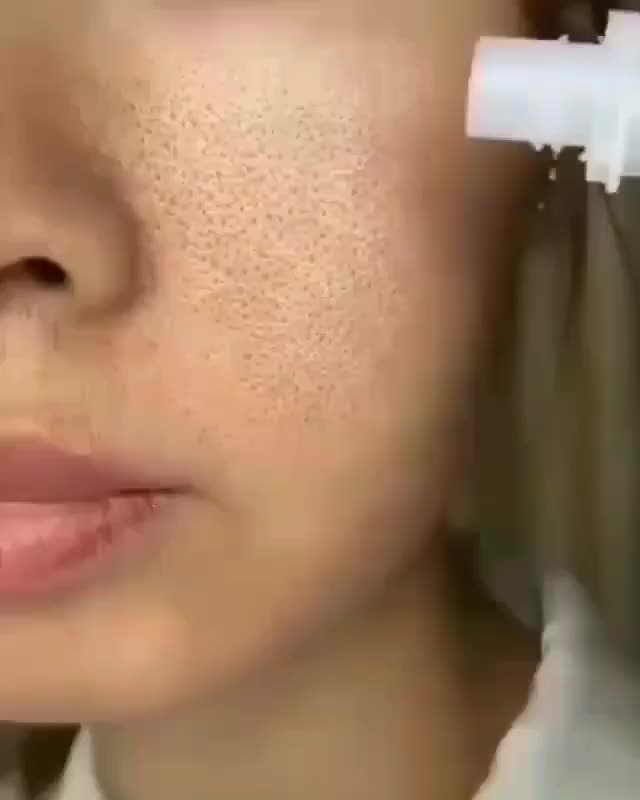 @7154699