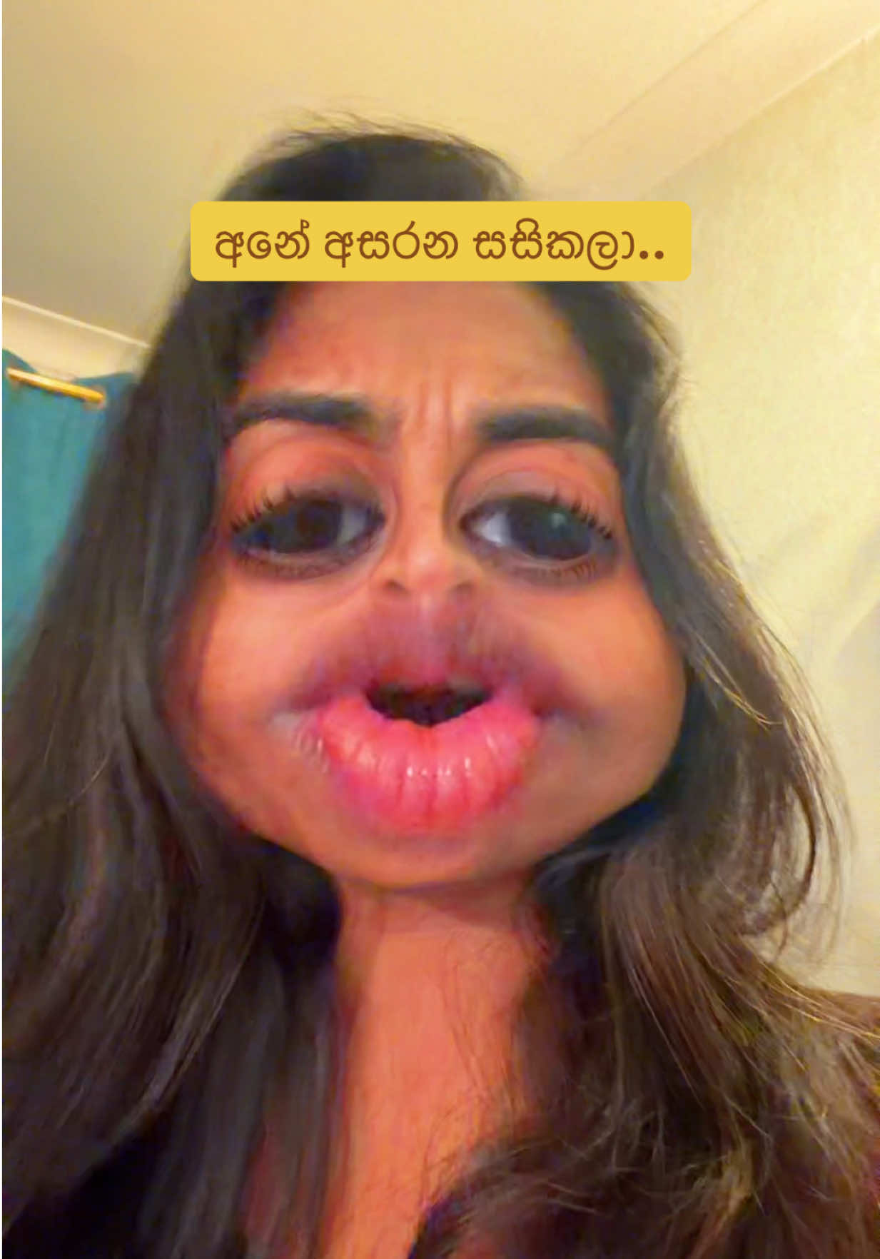 @ආදර චම්පා...
