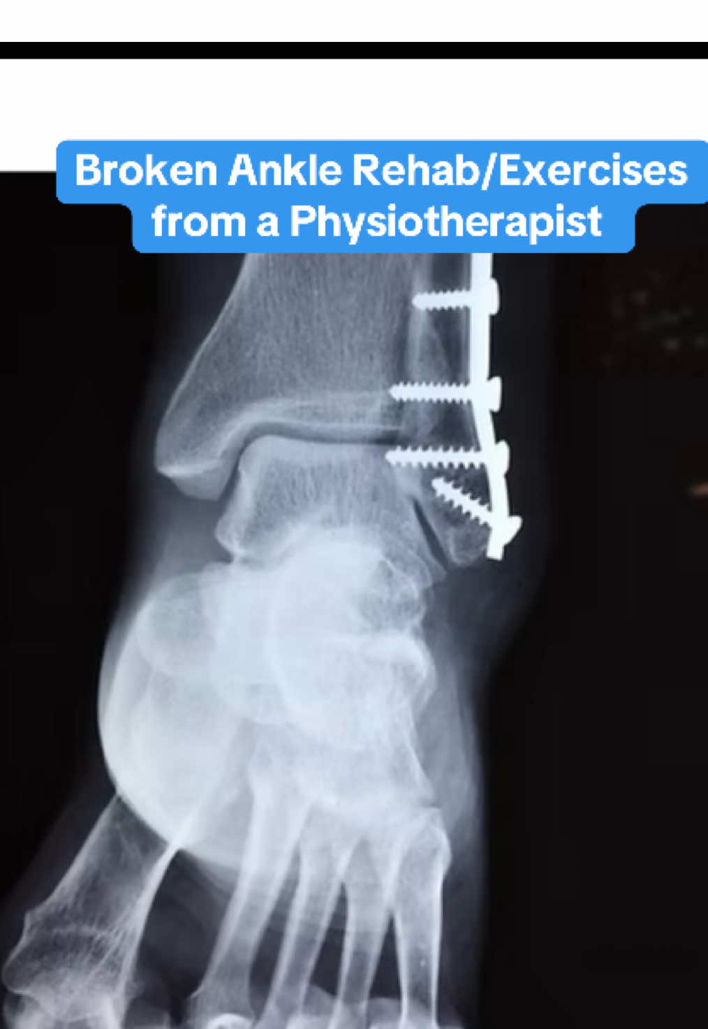 @The Physio Hack