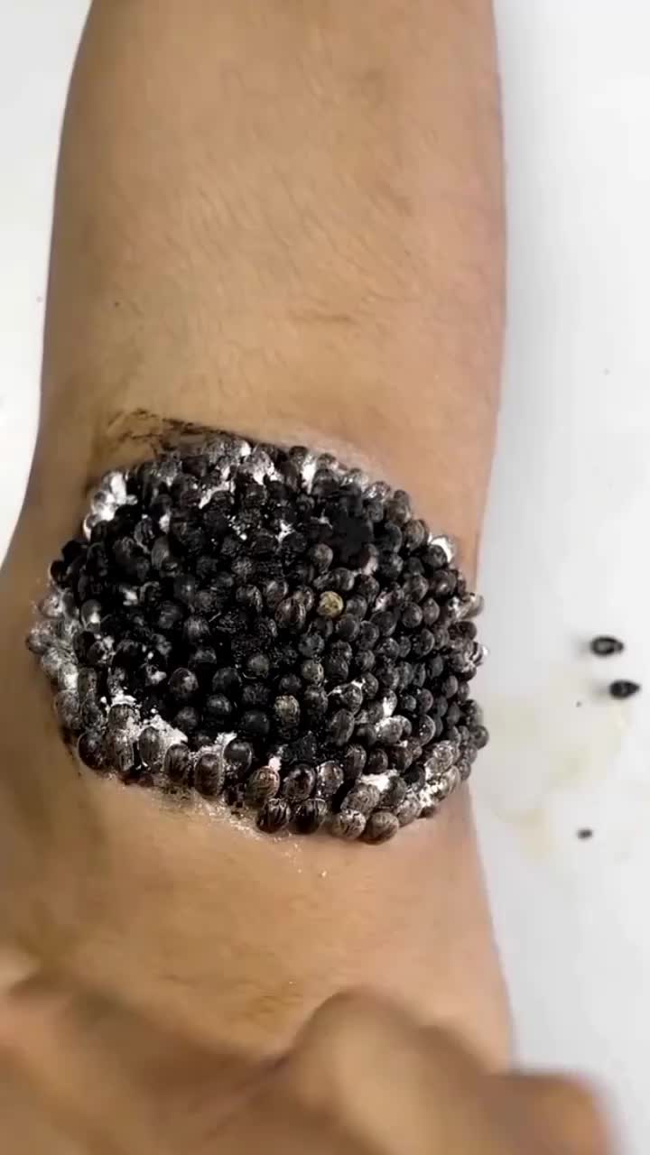 @tickyouu