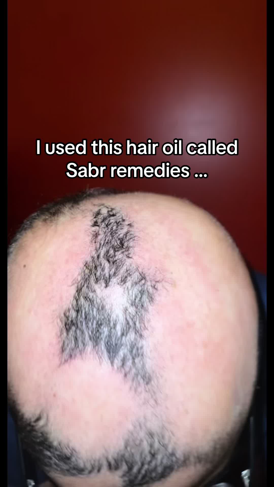 @SABR REMEDIES