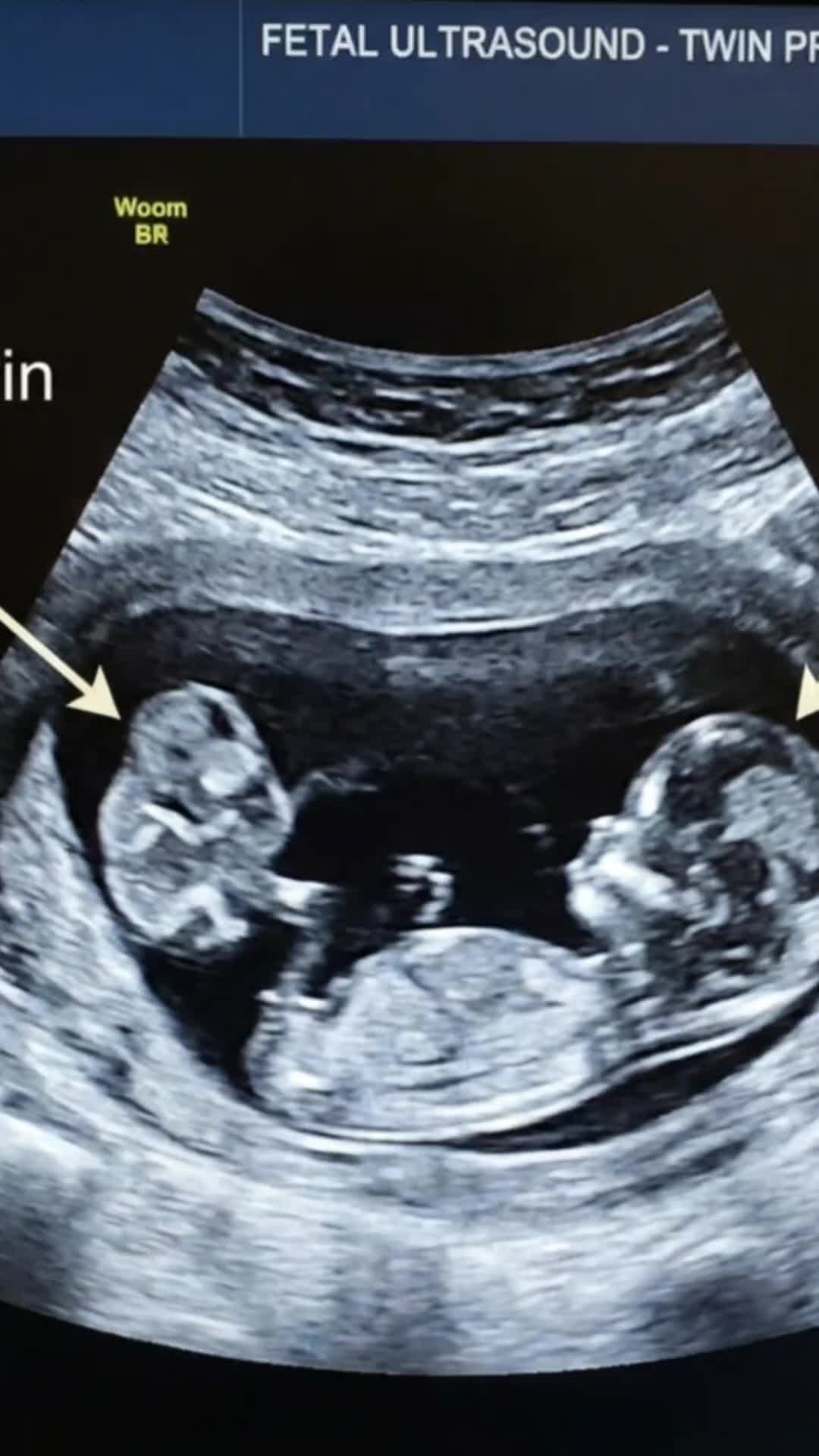 @Nurse Mum Guide