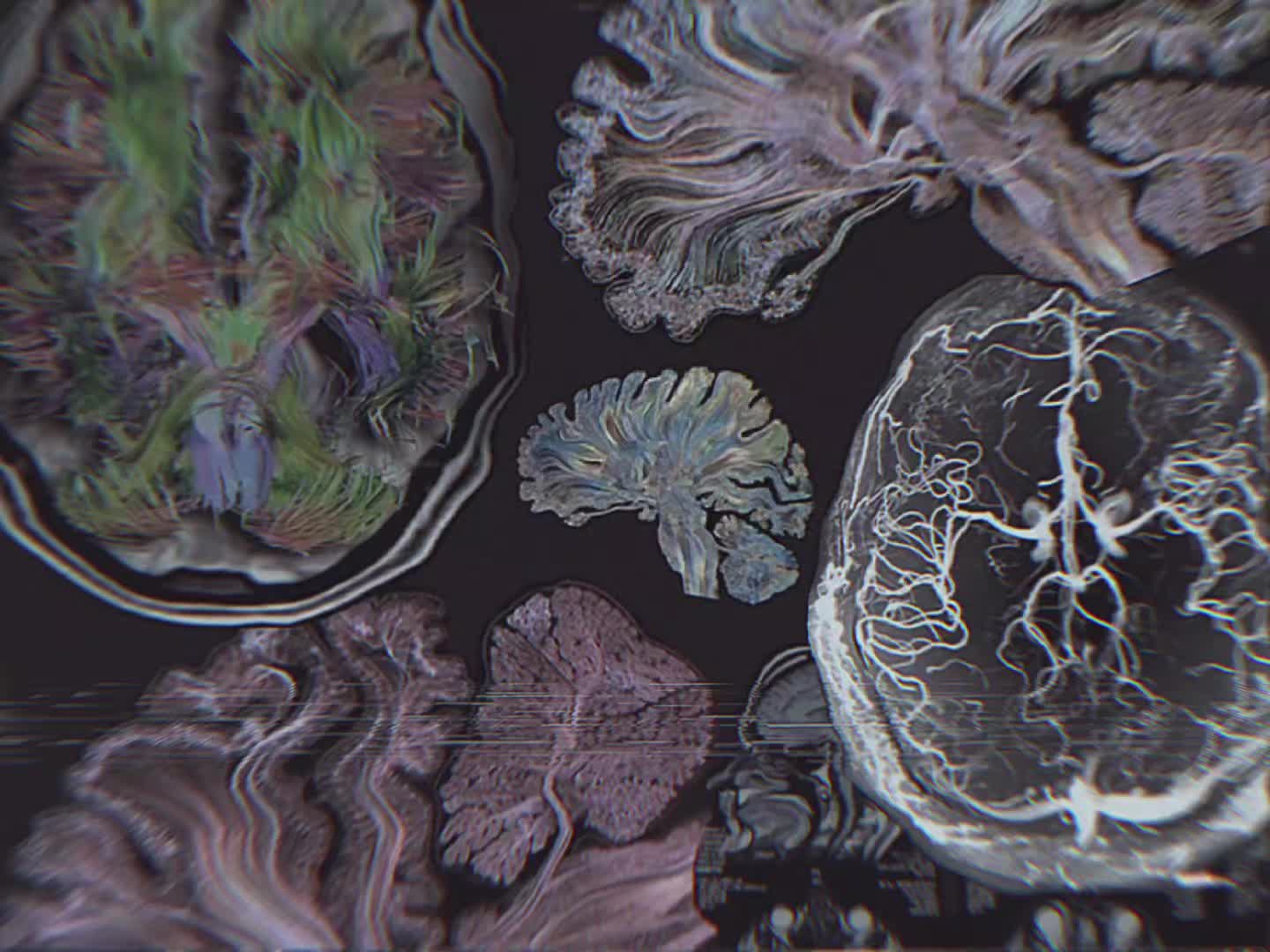 @BrainShift