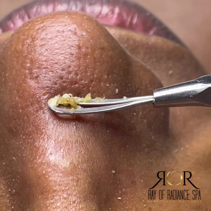 @Rosey-FL Esthetician/laserTech