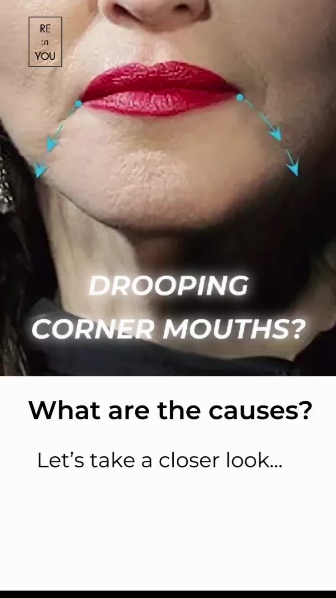 @RE:NYOU BODYFACE&reg;️