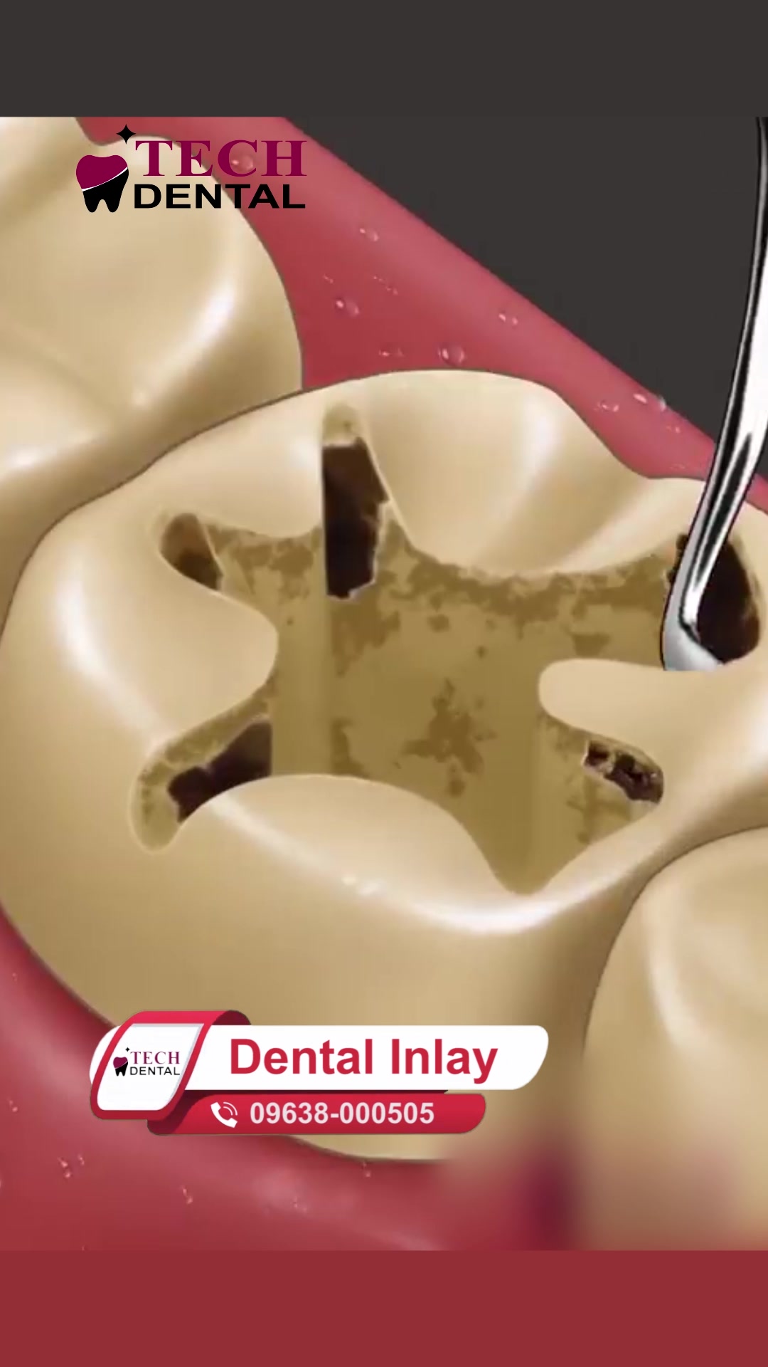 @Tech Dental