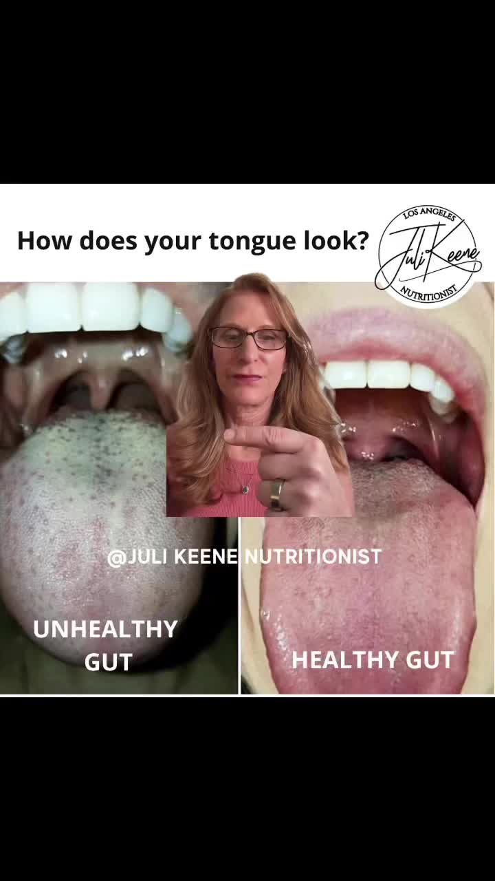 @losangelesnutritionist
