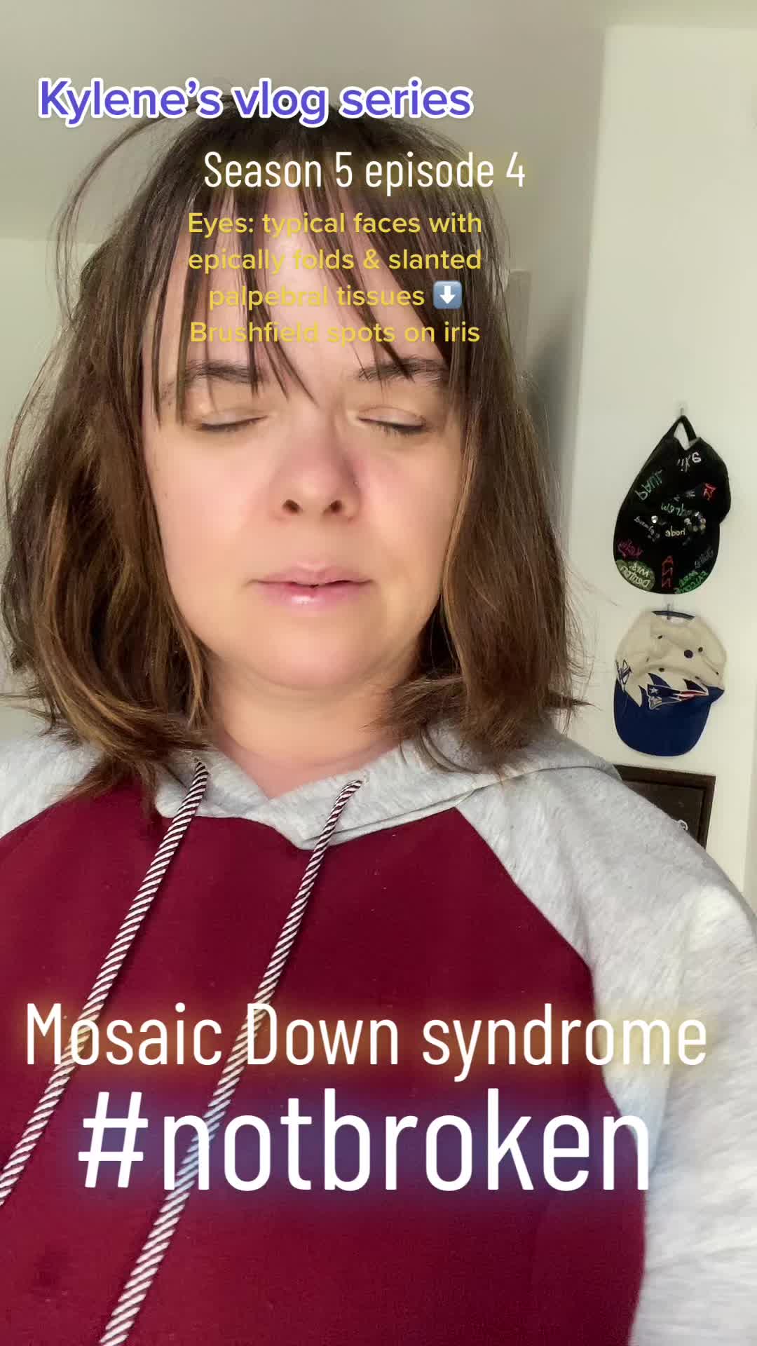 @Azkye4life&ensp;🦉🦋