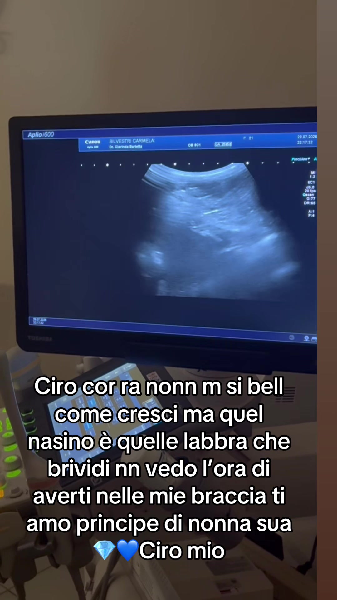 @Titta Franco