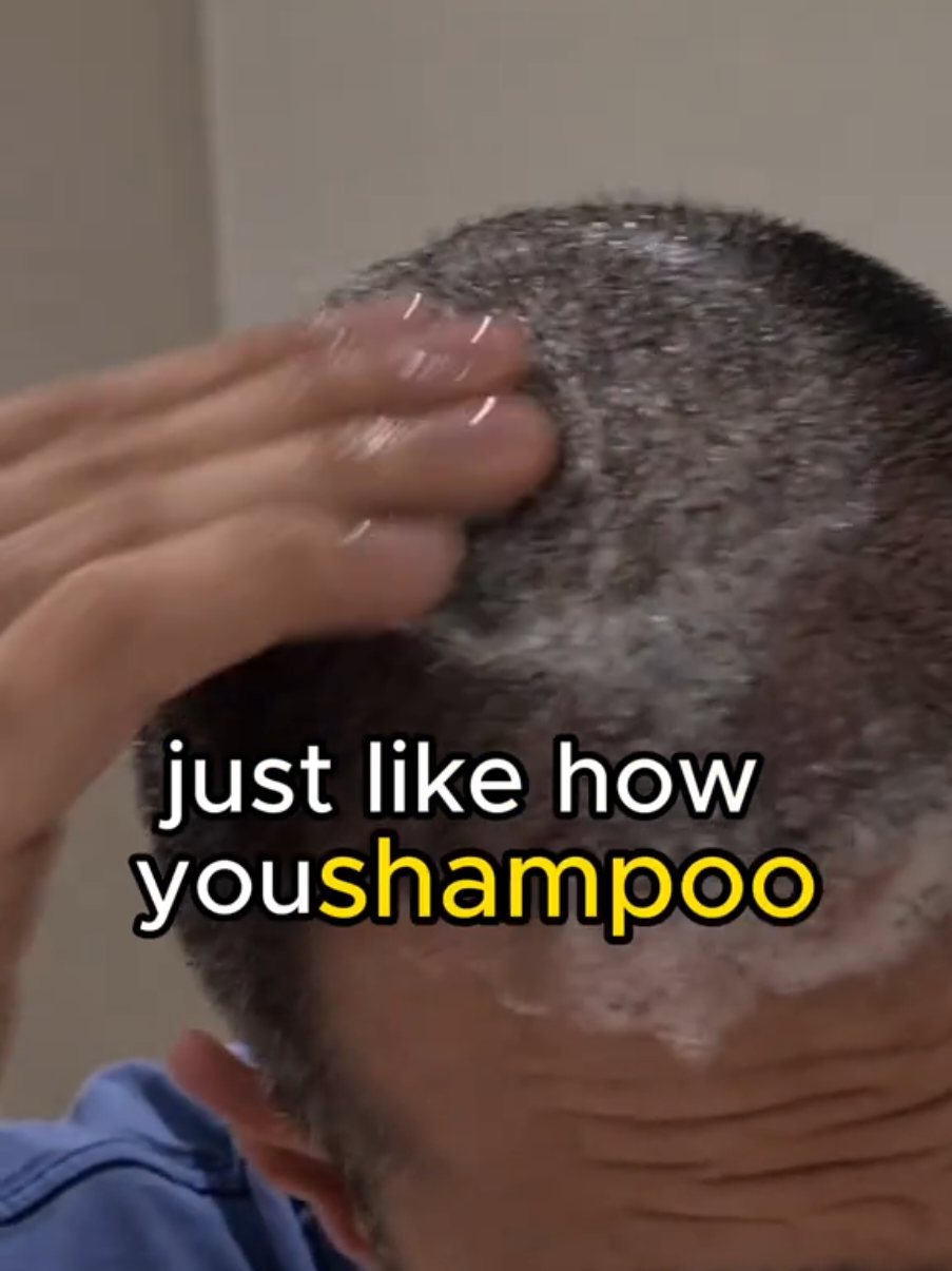 @Amit | Hair Transplant Tips