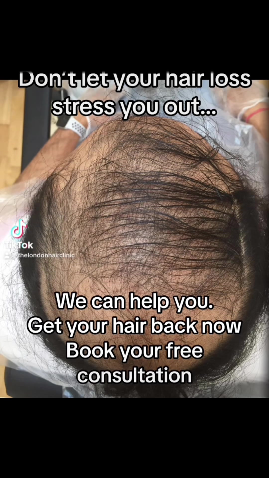 @TheLondonHairClinic