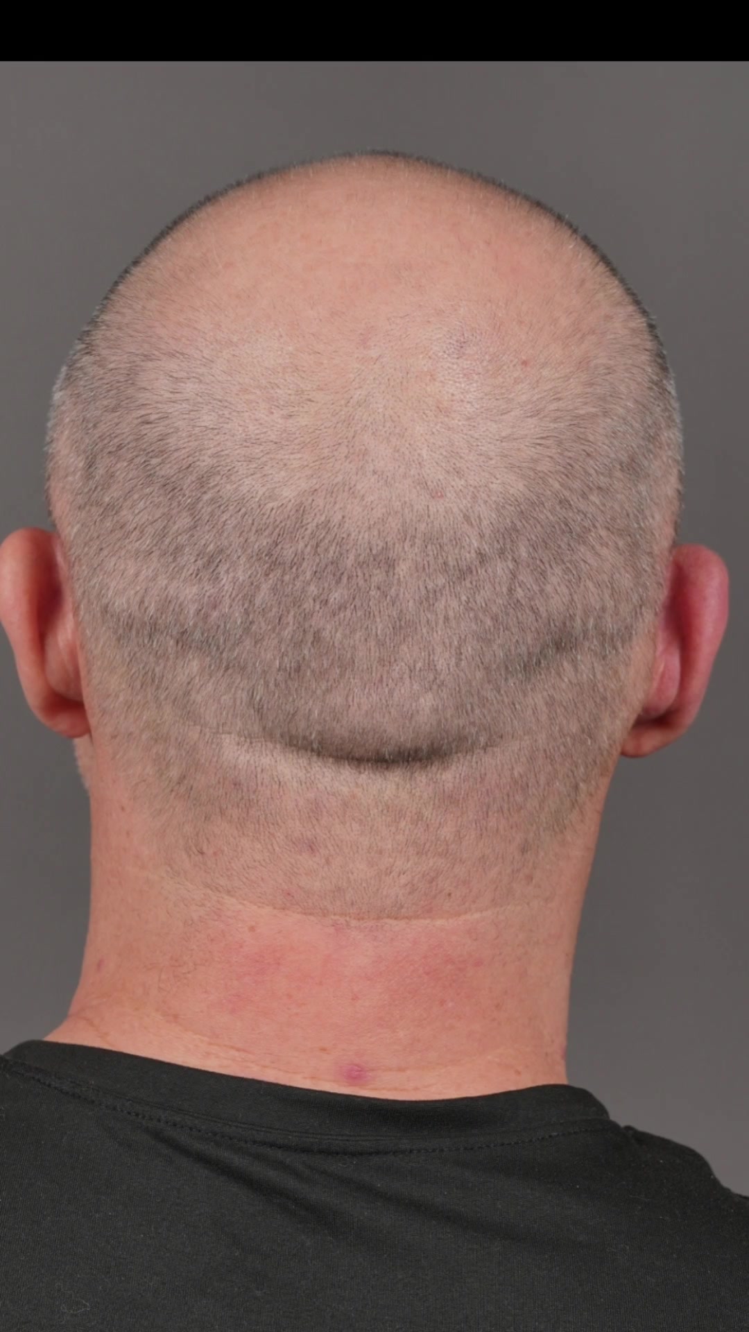 @Enhanced Scalp