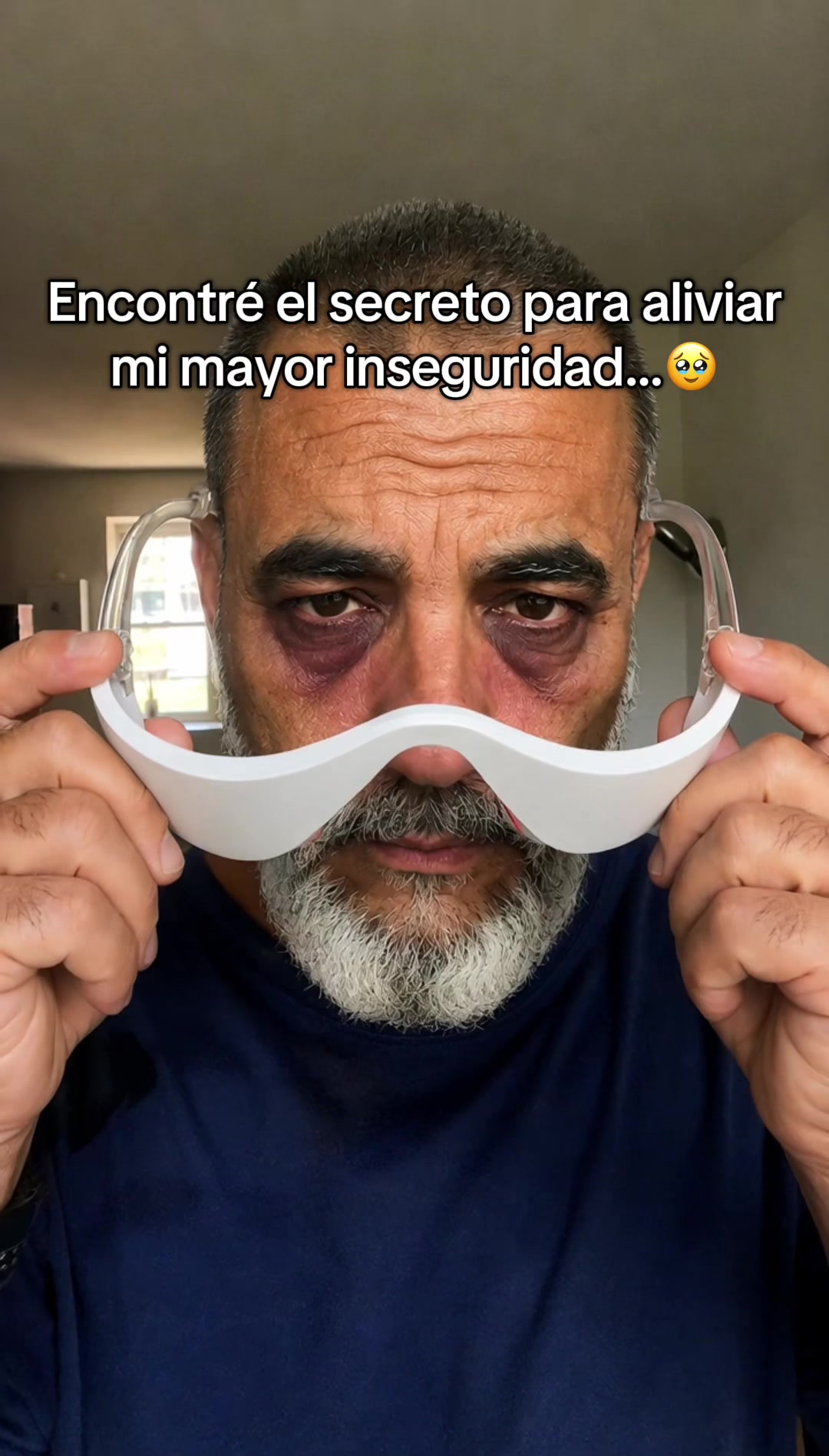 @myoculis