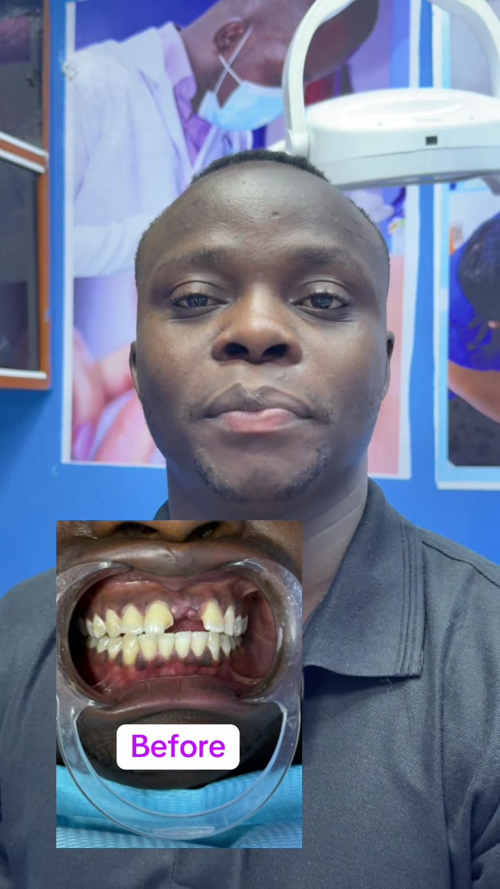 @THE SMILEY DENTAL KE