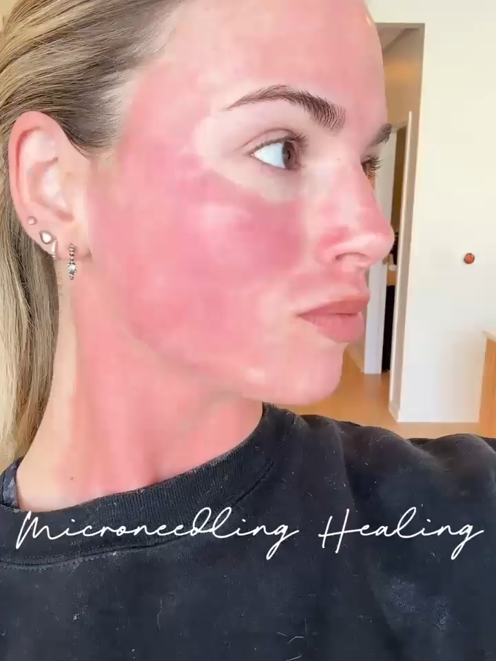 @renew laser med