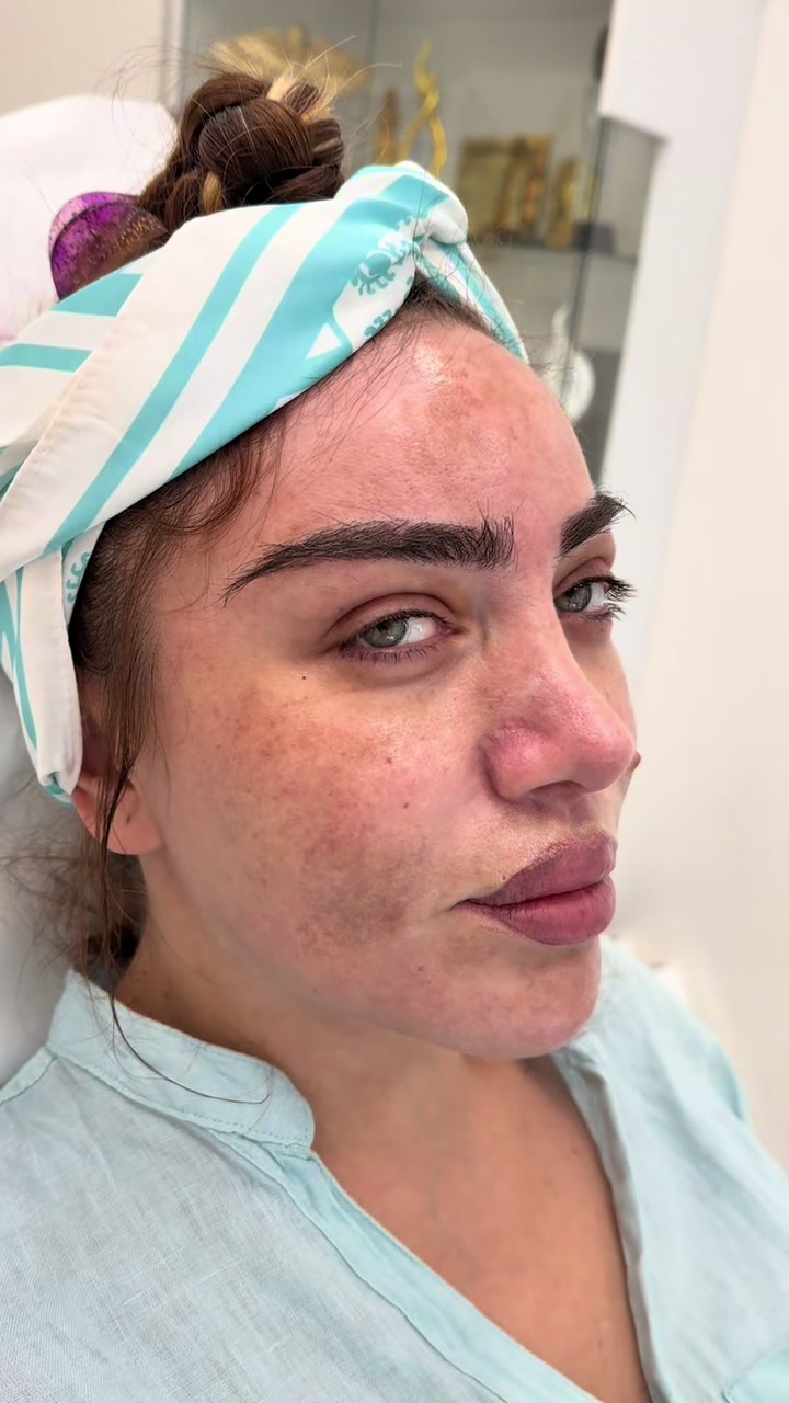 @Dr. Rəna Soltanova