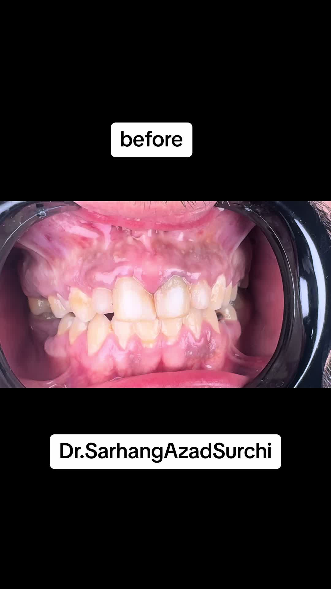 @Dr.Sarhang Surchi