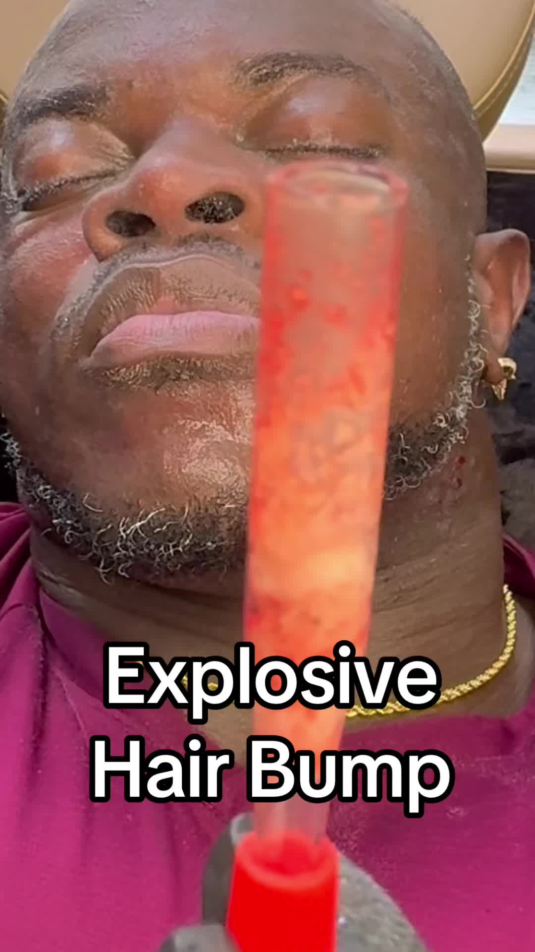 @Ronnie