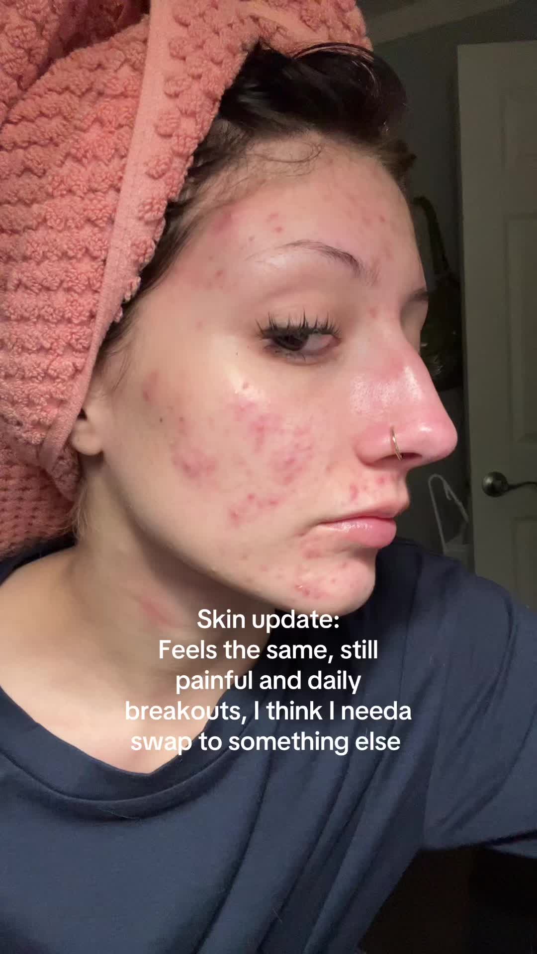 @:)