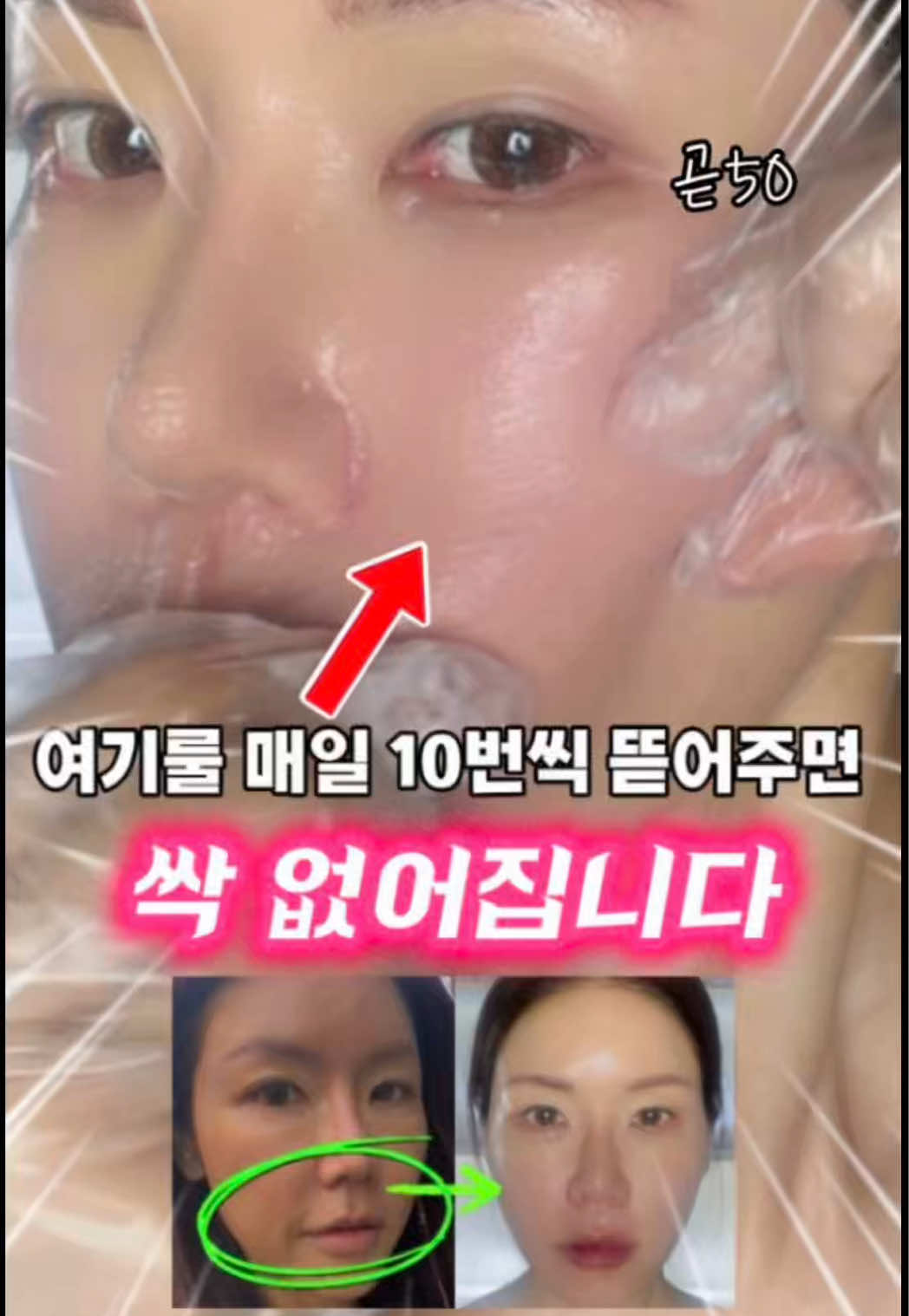 @지나스 GINAS