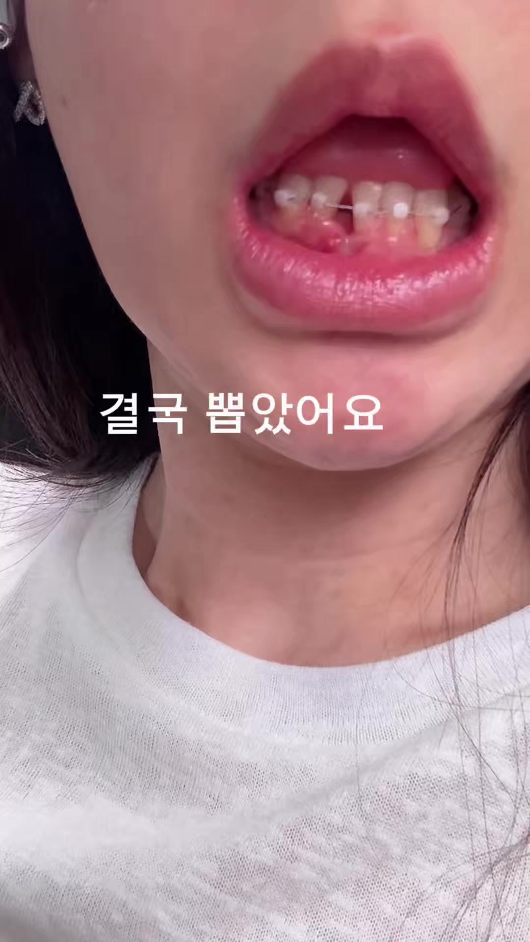 @윤블링