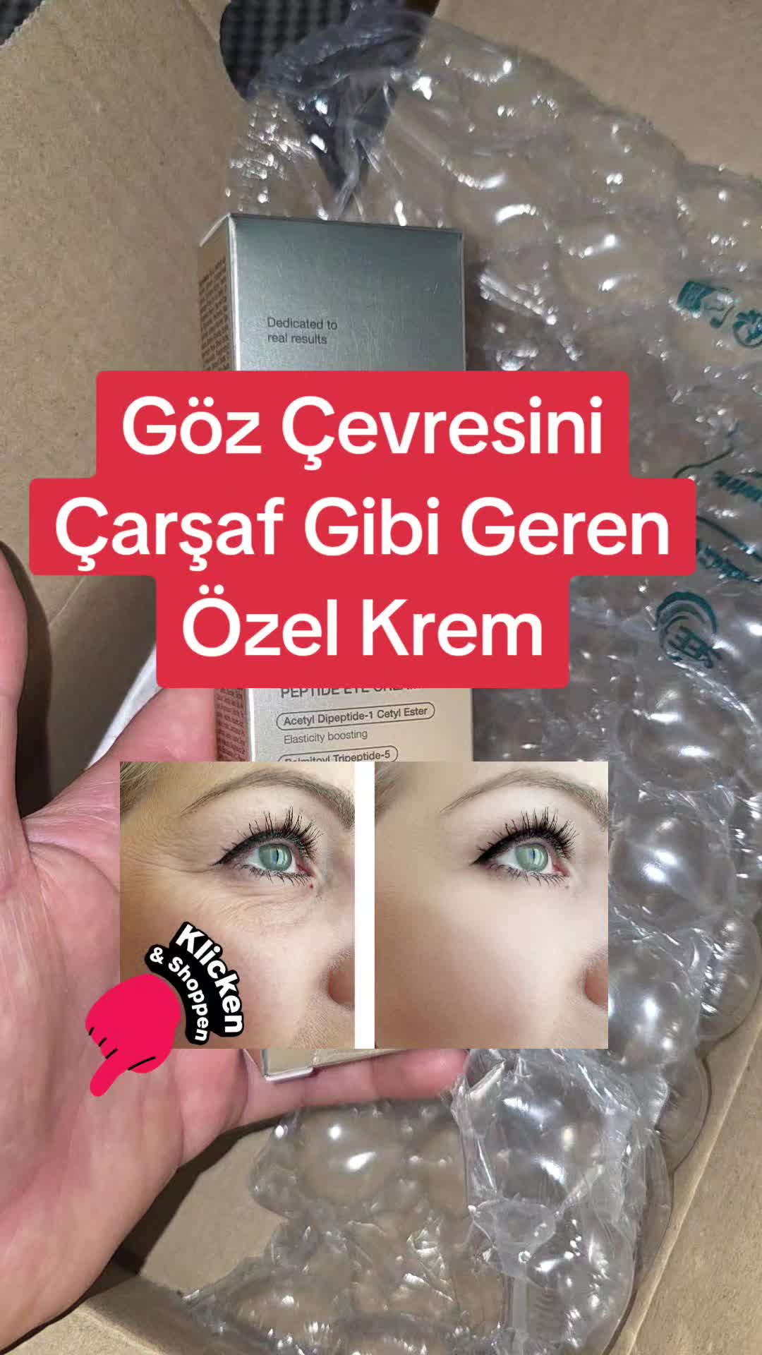 @Gurbetana27