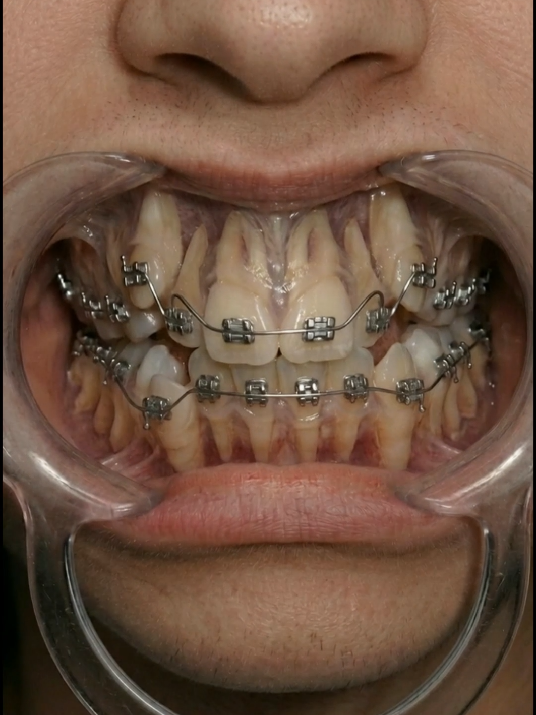 @Denti AI
