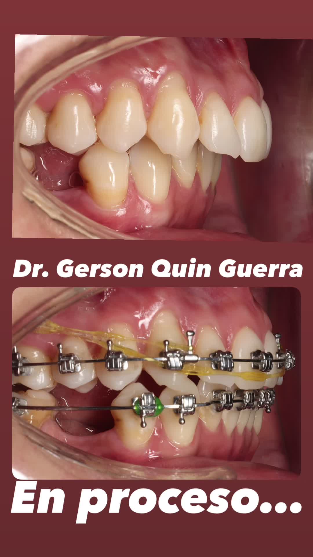 @Dr. Gerson Quin Guerra, PhD