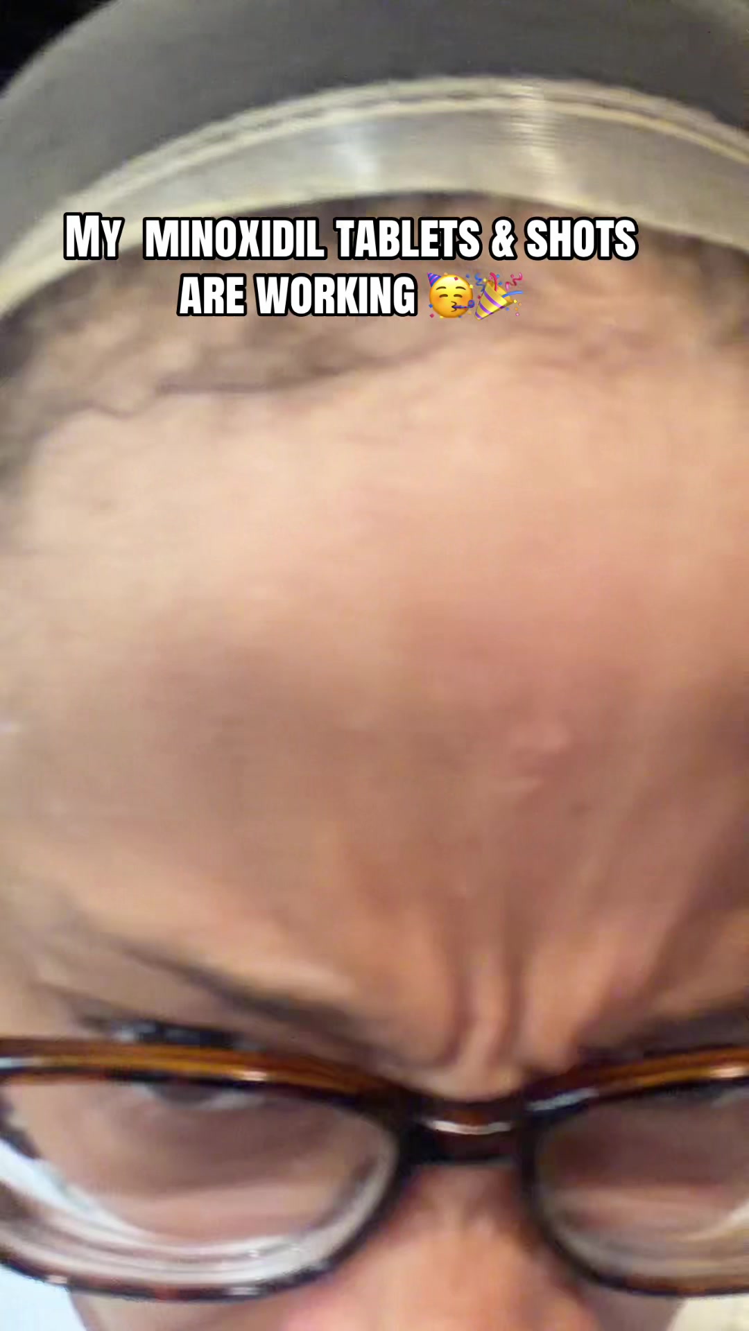 @Honeyhunncho