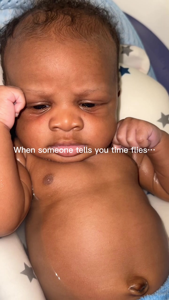 @braceface_redd29