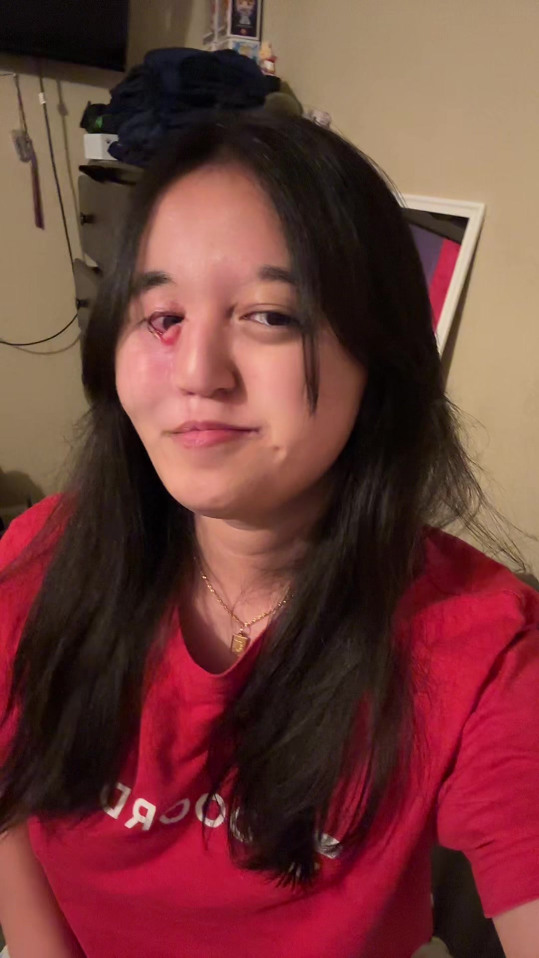 @dev