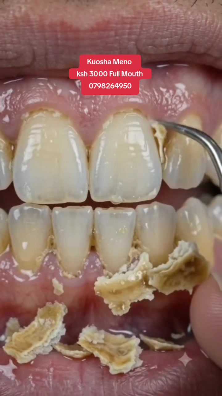 @MIRAHN DENTAL CARE