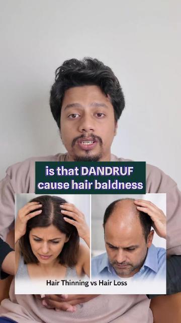 @NAZID HAIR TRANSPLANT