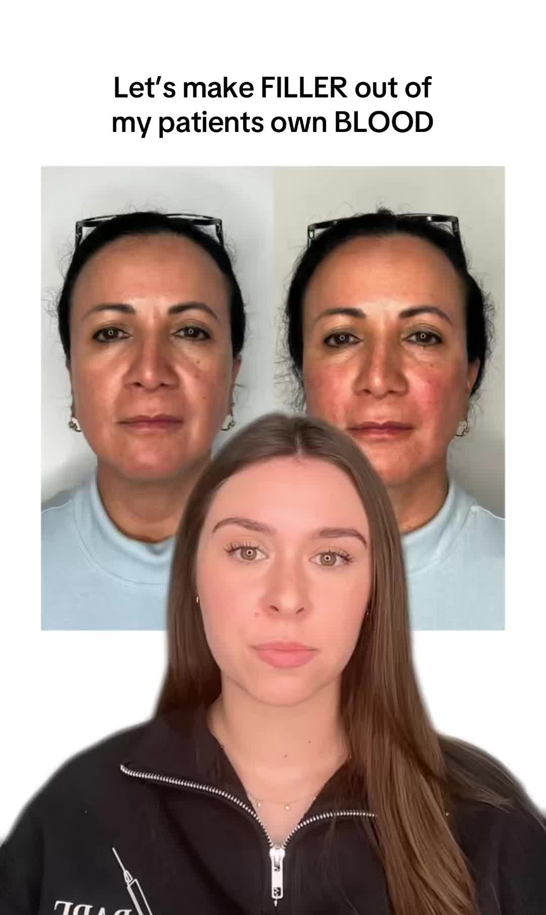 @injectoraleenp