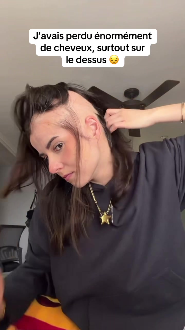 @Lux’Hair Growth