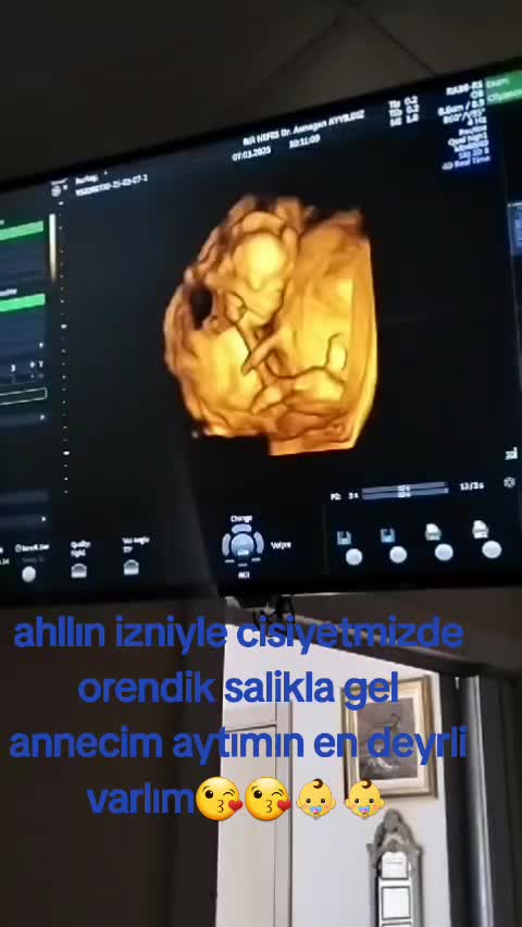 @cansel