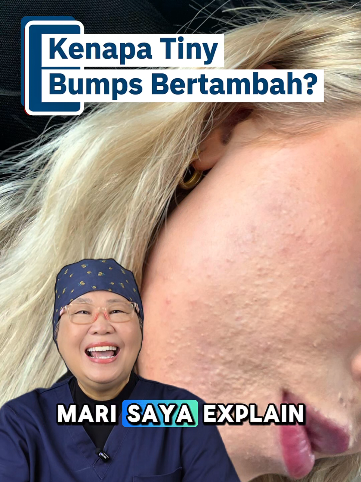 @Nora Mun | Tips Kesihatan
