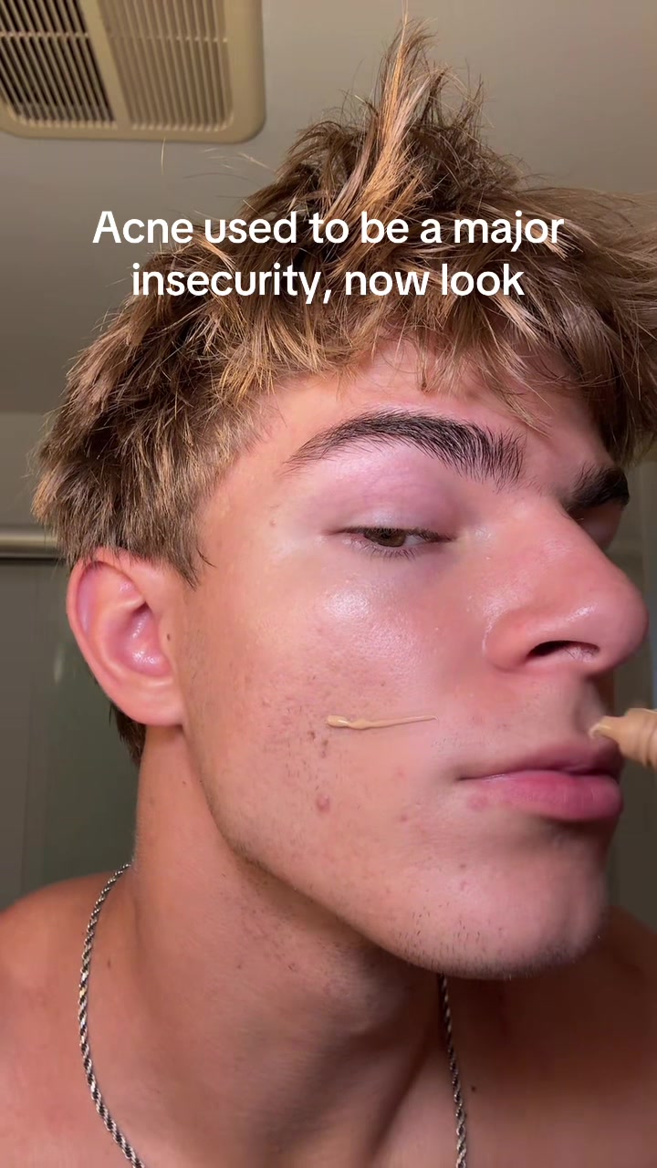 @Finn