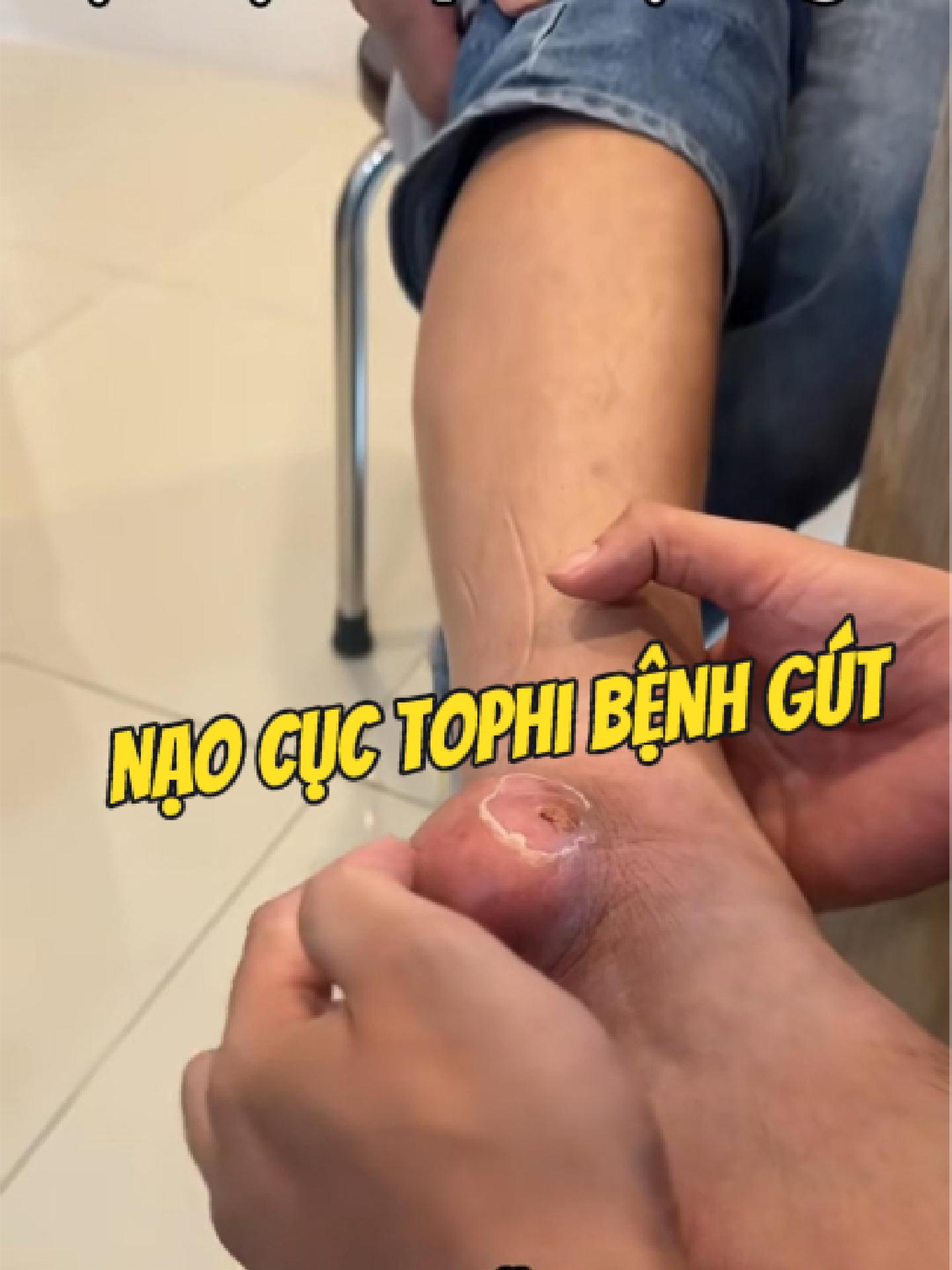 @Chuy&ecirc;n gia xương khớp