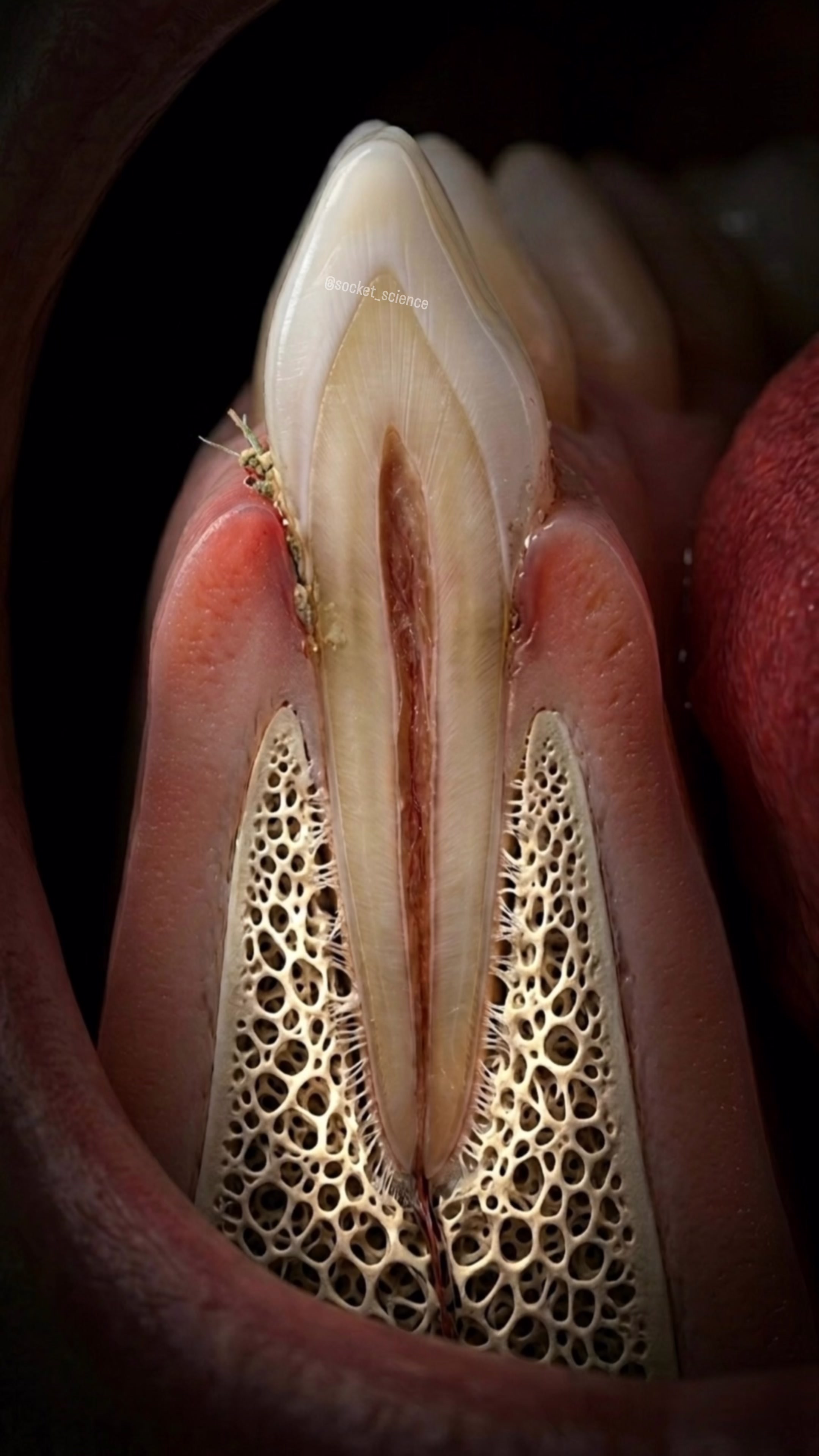 @Socket Science | Dental Visual
