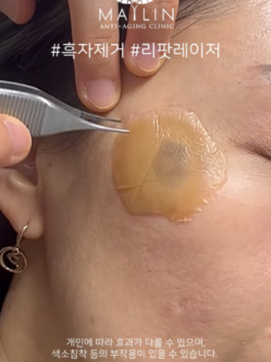 @메이린의원대구점