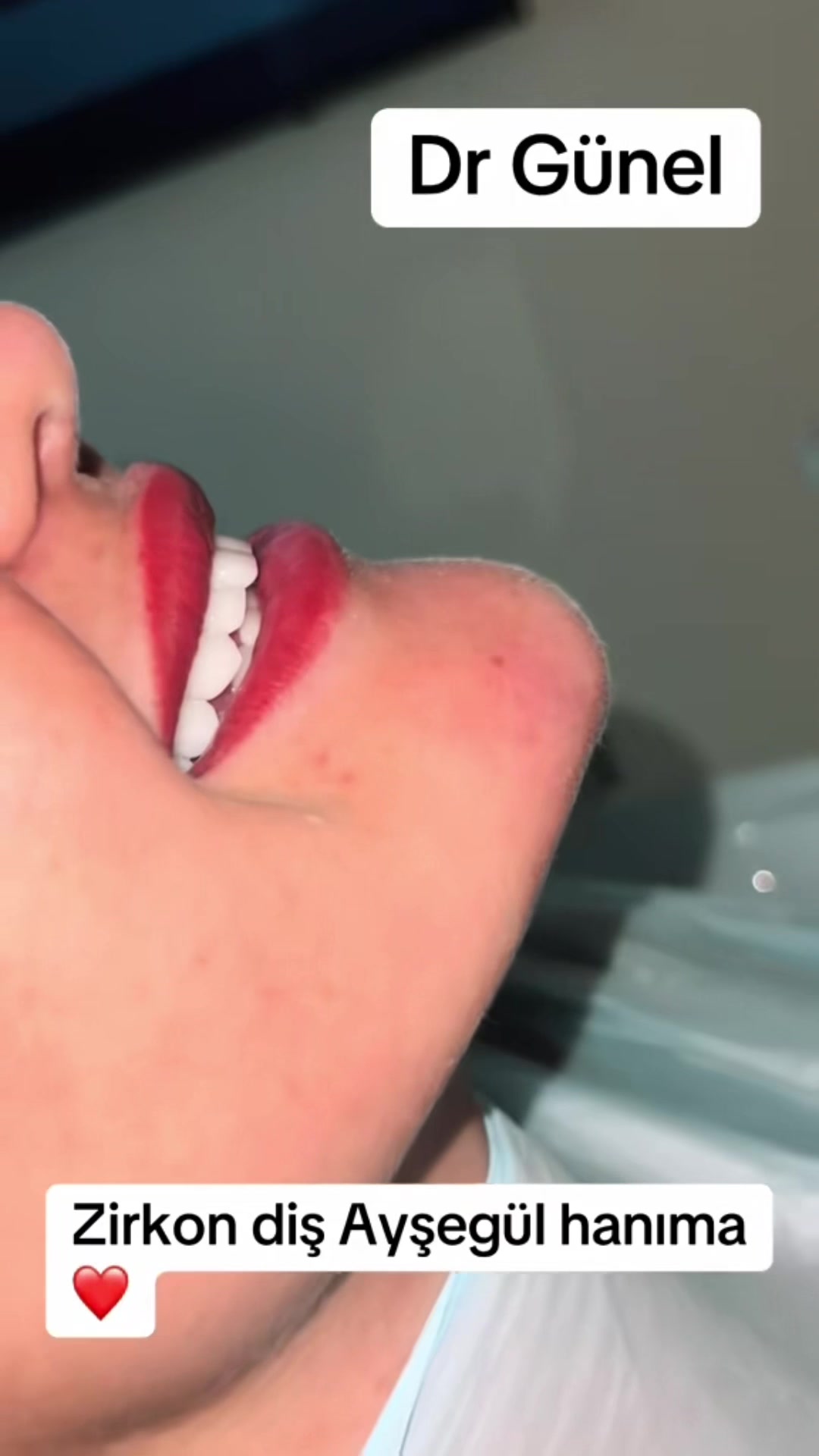 @Dentist_Günel