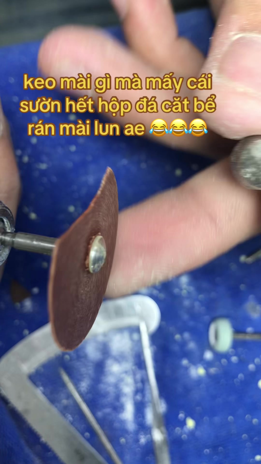 @Hùng răng sứ 🦷🦷