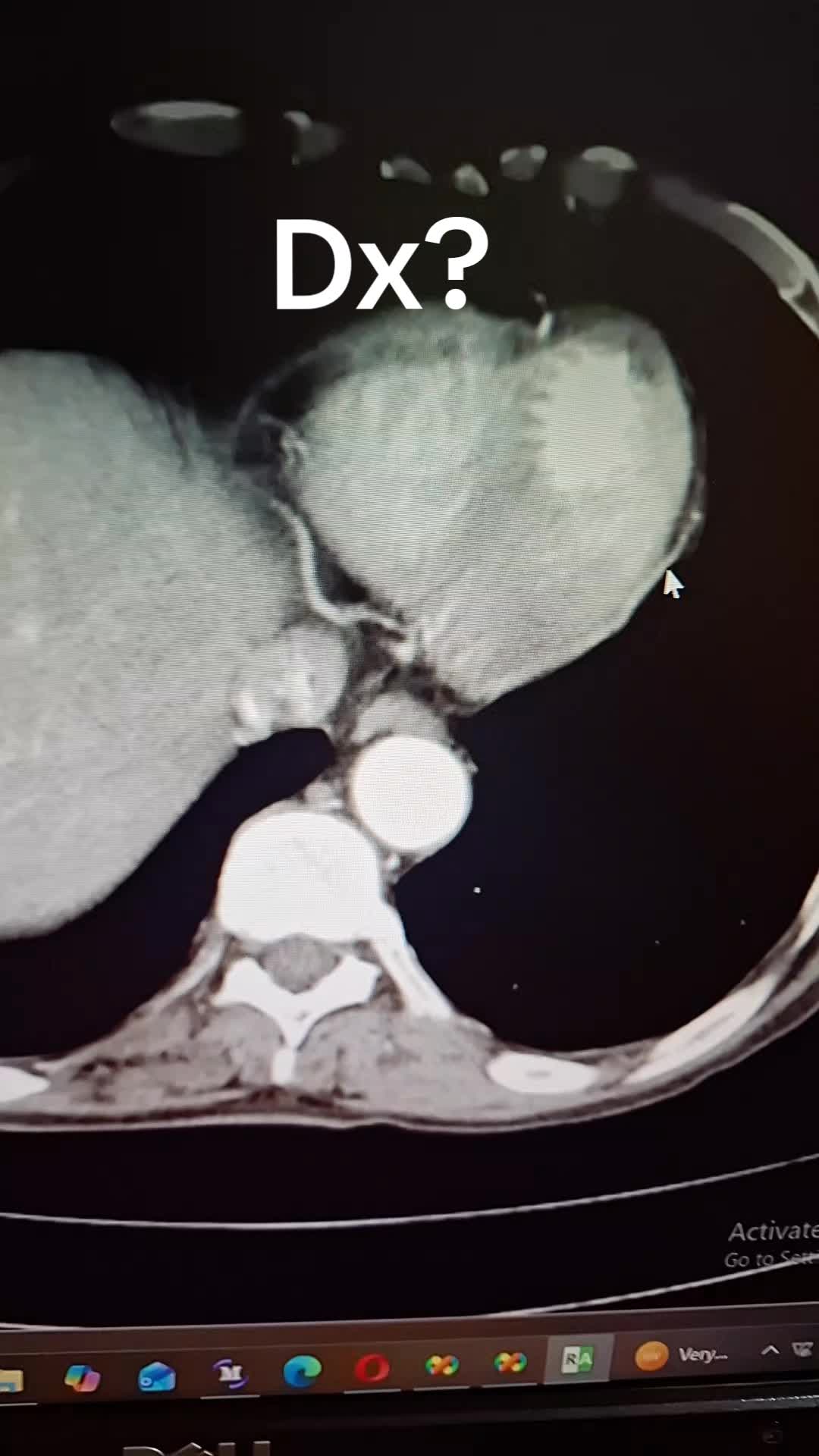 @Dr Wubie Endalew(Radiologist)
