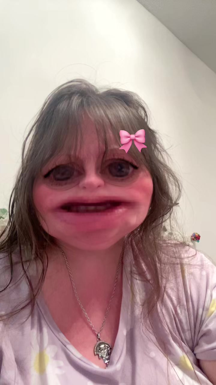 @Audrey