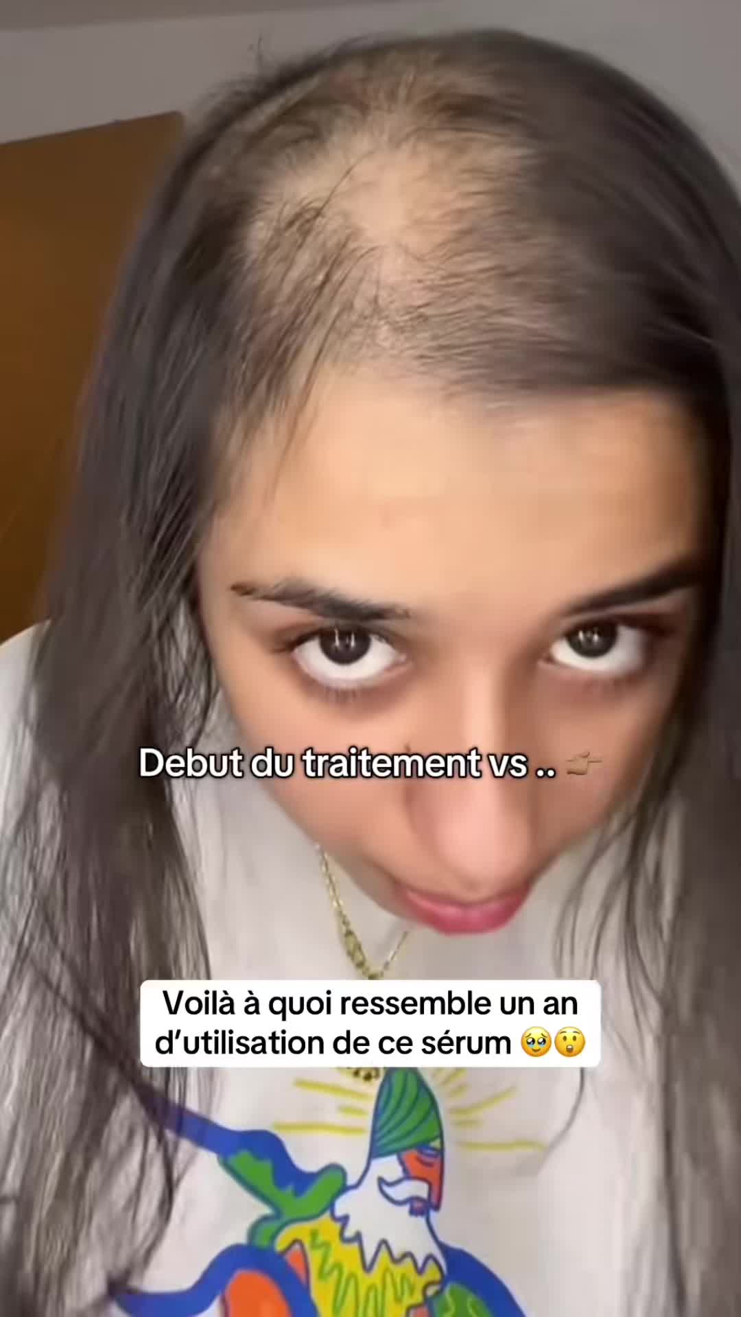 @Lux’Hair Growth FR
